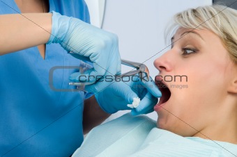 tooth extraction, scared patient
