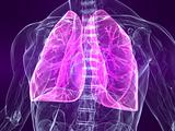 marked lung