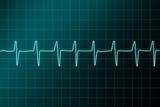 Cardiogram ritm