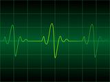 Heart cardiogram 