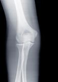 X-ray Knee
