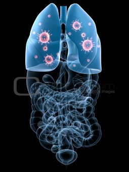 lung infection