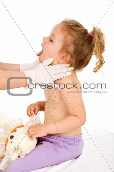 Little girl with small pox at the doctors