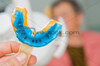 Dental imprint