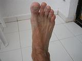Sandy foot
