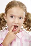 Girl missing tooth putting her finger in her mouth