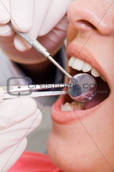 dental inspection
