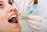young beautiful woman for dental inspection