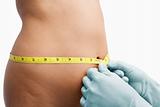 Female mid section being measure before liposuction
