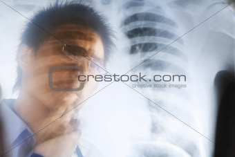 Asian doctor examining xray negative