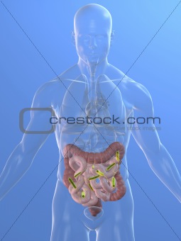 colon infection