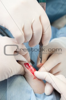 Veterinarian doing knee surgery on small dog