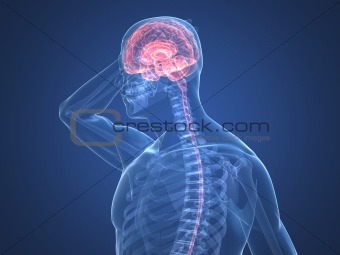 headache/migraine illustration