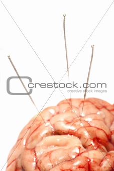 needled brain