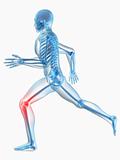 running man - painful hip