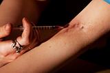 Woman wih tracks on her arm injecting heroin