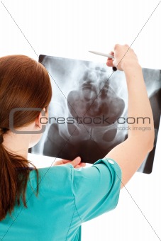 Rear view of young female doctor examining a xray