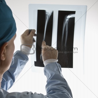 Doctor pointing at an x-ray.