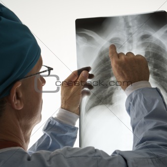 Mid-adult Caucasian male doctor pointing at a bone on a x-ray.