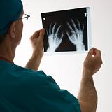 Doctor holding an x-ray.