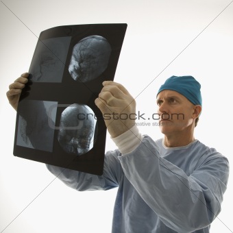 Doctor looking at an x-ray.