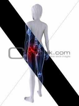 x--ray female skeleton