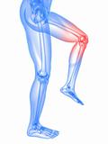painful knee illustration