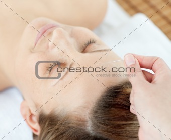 Acupuncture needles on an attractive woman's head 