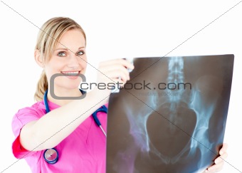Glowing young surgeon holding a x-ray 