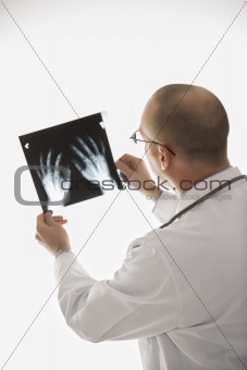 Doctor looking at xrays.