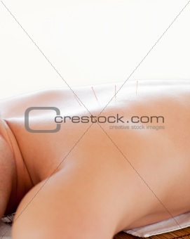 Close-up of a caucasian man receiving an acupuncture therapy