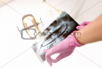 Dentist X-ray Detail