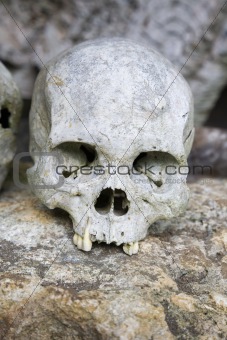 Skull
