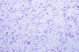 Purple Disinfectant Wipes