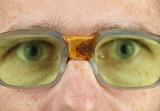 Person in old bad spectacles with poor eyesight