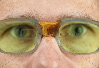 Person in old bad spectacles with poor eyesight