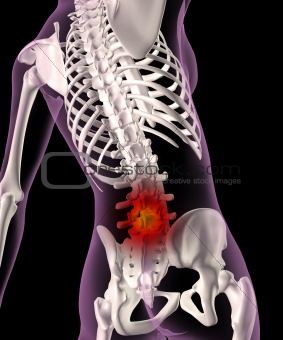 Back ache in a female skeleton