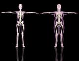 Medical female skeletons one slim and one overweight