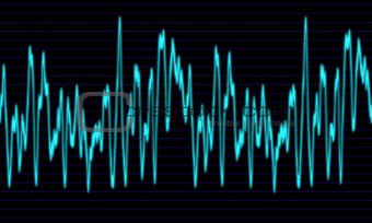audio wave