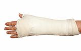 Broken arm in cast and bandage
