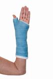 Broken arm in blue cast