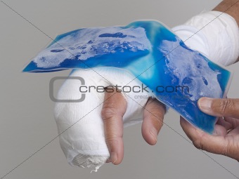 Ice pack being held on hand in cast