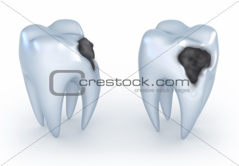 Teeth with caries, 3D image on white background.