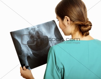 Female doctor examining an x-ray image. Focus is on the x-ray