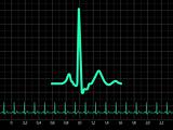Electrocardiogram (EKG). EPS 8