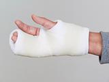 Hand and fingers in white cast