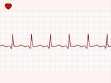 Normal electronic cardiogram. EPS 8