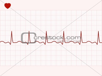 Normal electronic cardiogram. EPS 8