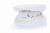 Teeth gypsum model 