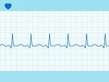 Heart cardiogram fully editable. EPS 8